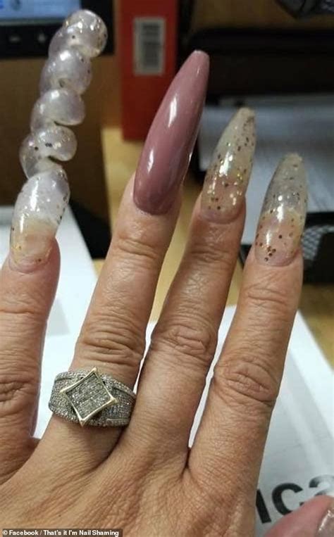 Ugly nails. Things To Know About Ugly nails. 